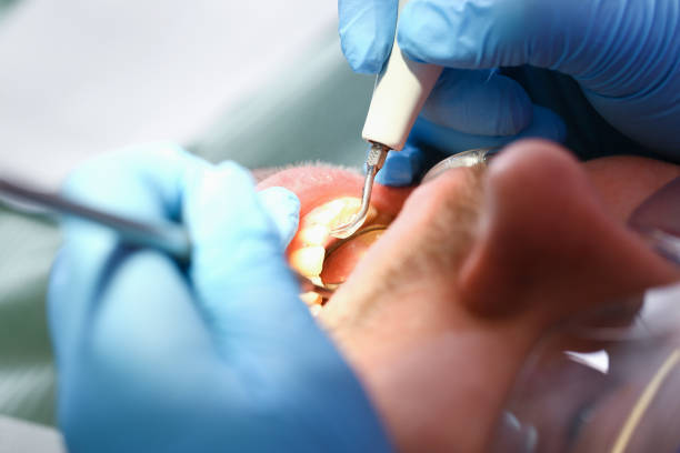 Best Urgent Care for Lost Fillings or Crowns in Kerrville, TX