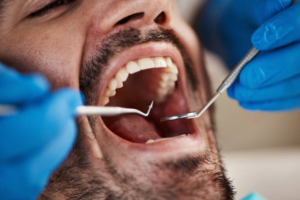 Best Emergency Dental Care for Broken or Chipped Teeth in Kerrville, TX