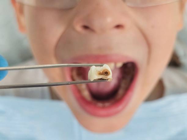 Best Weekend Emergency Dentist in Kerrville, TX